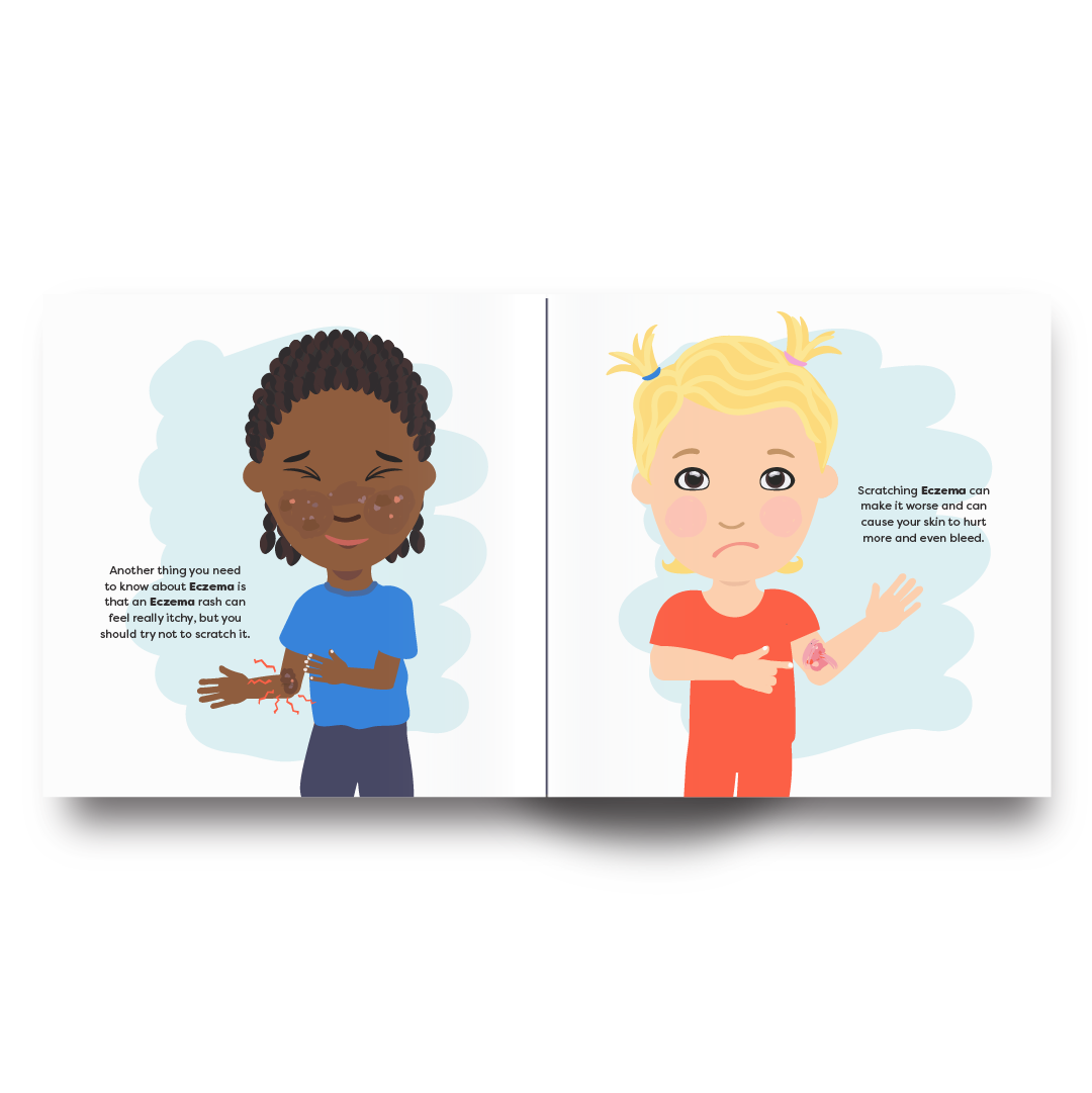 E is for Eczema